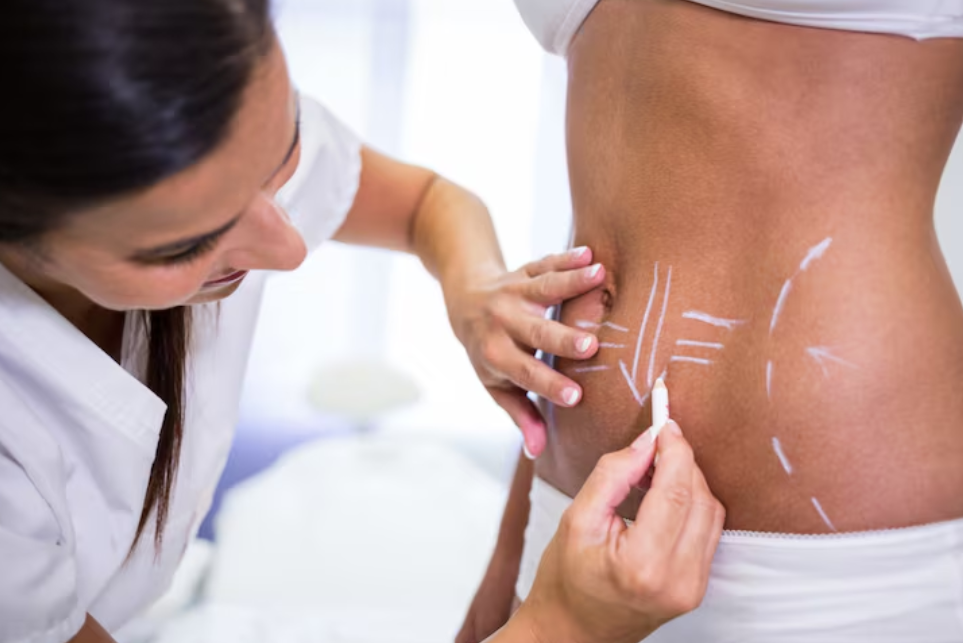 Como Escolher entre Caneta Overseas Marcação Estéril e Não Estéril